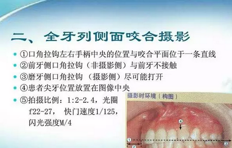 深圳義齒加工